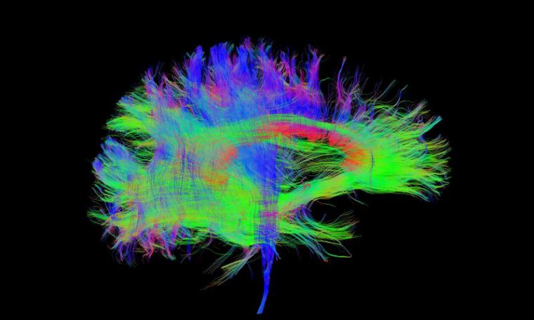 Multicolored image of the neural connections within a brain.