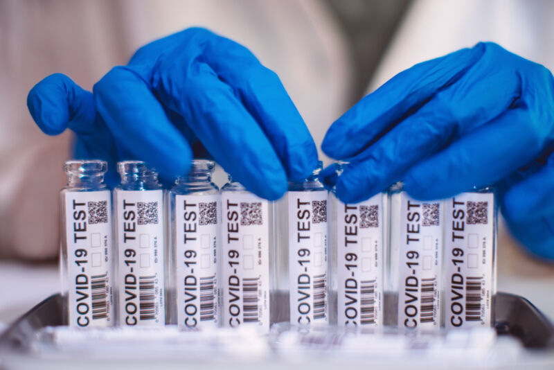 Doctor in protection gloves examining & organising test kit for COVID-19 in laboratory.