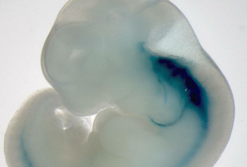 A gross white blob looks vaguely like a human ear.