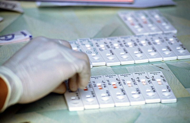 A hand in a protective glove handles test kits and samples.