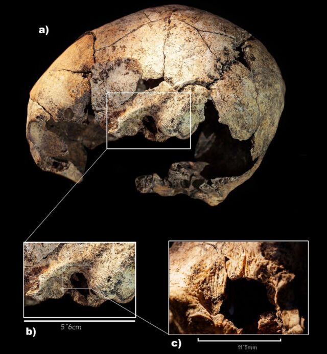 Set of cut marks identified on the left temporal bone of the skull. Insets: enlarged images of the cut marks in the left ear, next to the mastoid.