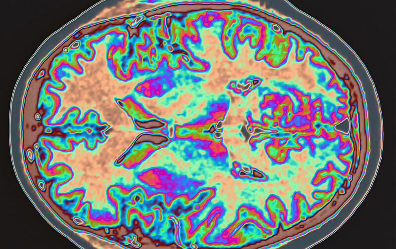 Colorful brain scan.