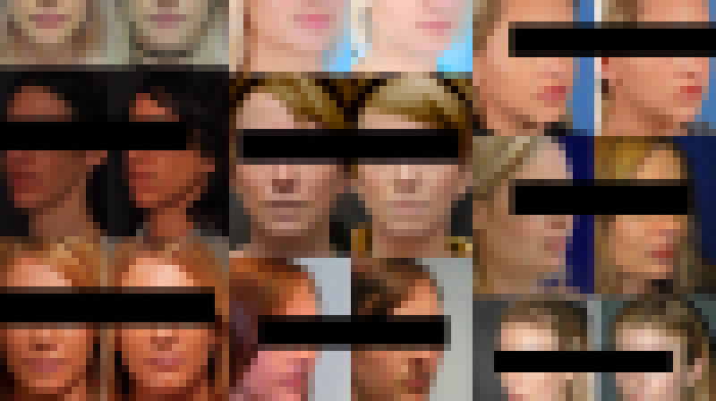 Censored medical images found in the LAION-5B data set used to train AI. The black bars and distortion have been added.