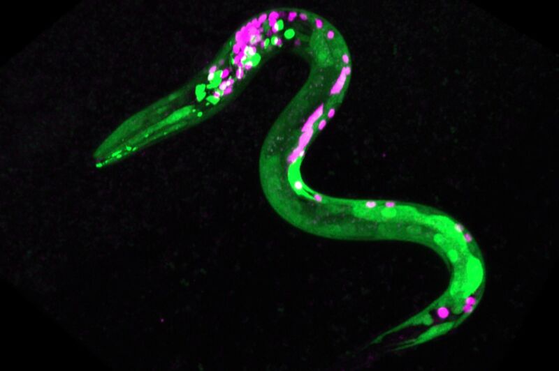 Image of worm that is genetically engineered so that certain neurons and muscles are fluorescent