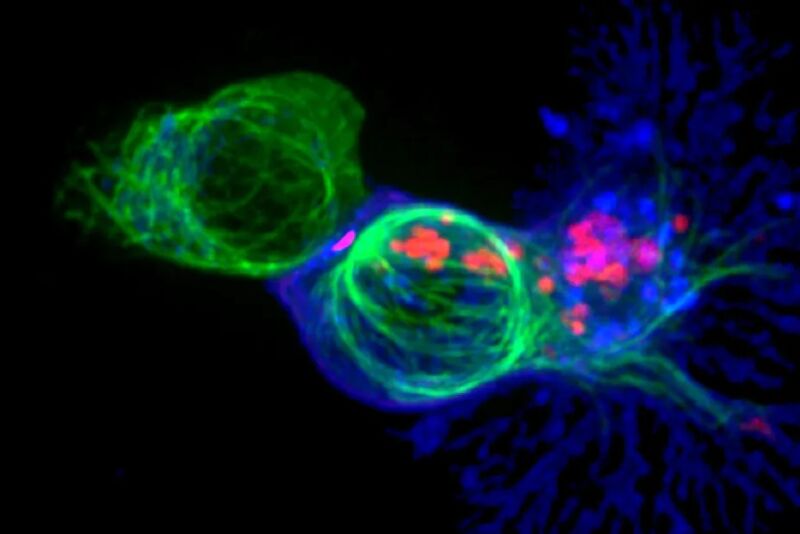 image shows a cytotoxic T cell attacking a cancer cell by releasing toxic chemicals