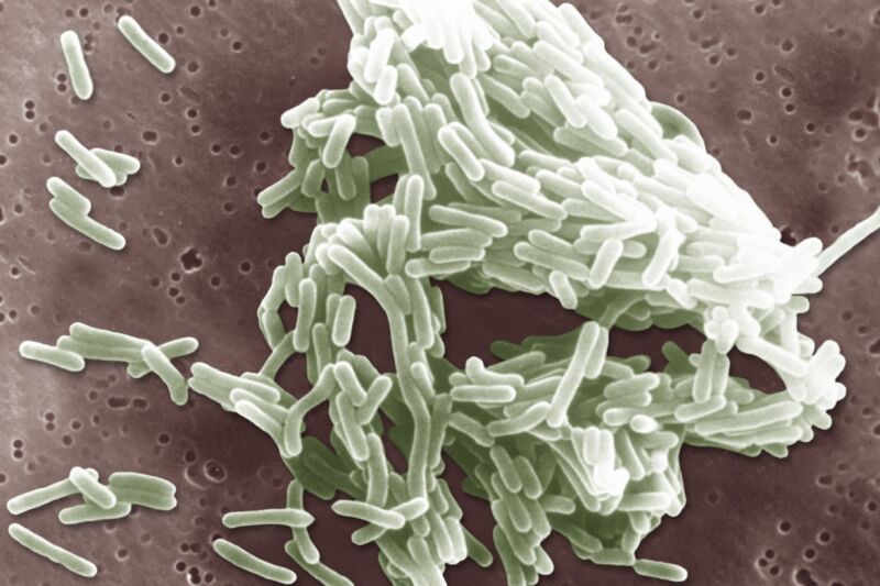 Listeria monocytogenes.